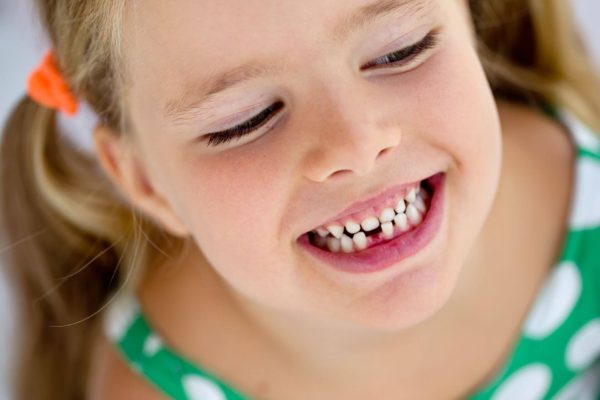 Dolore della dentizione: cosa fare?